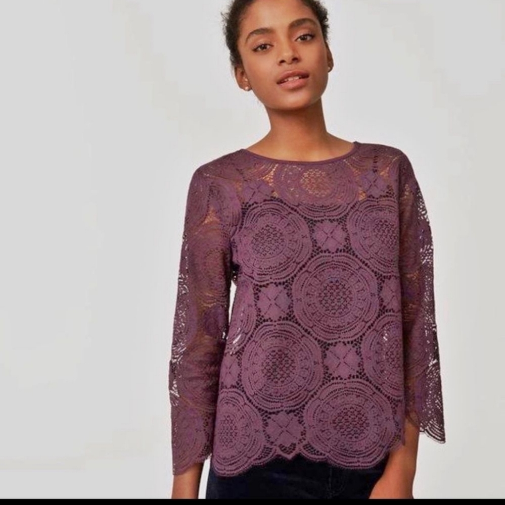 Loft lace medallion